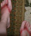 Wal-mart sold toxic flip-flops from China that cause blisters